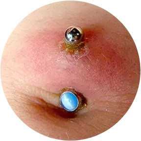 ¿Cómo saber si mi piercing está infectado y qué hacer?